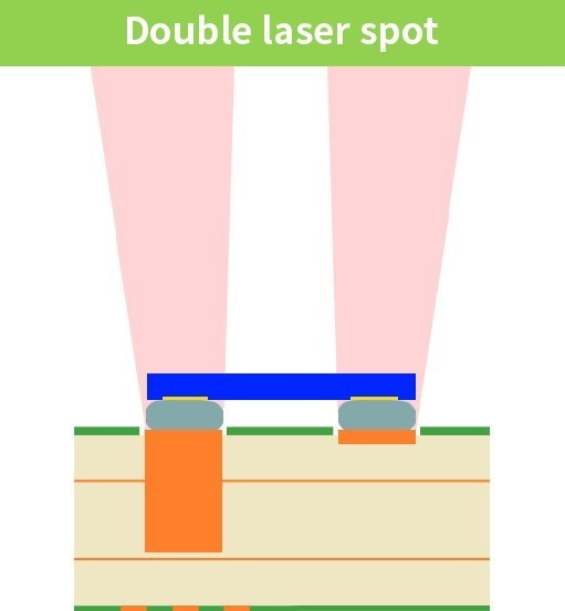 LBS-mini：Dual Spot - Laser System - 3